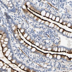 SLC30A7 Antibody, Novus Biologicals:Antibodies:Primary Antibodies