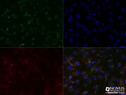 SLC31A1/CTR1 Antibody (5E6.1B4) - BSA Free, Novus Biologicals 0.025 mg | Buy Online | Novus Biologicals | Fisher Scientific