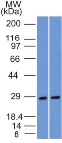 SLC31A1/CTR1 Antibody (5E6.1B4) - BSA Free, Novus Biologicals 0.025 mg | Buy Online | Novus Biologicals | Fisher Scientific