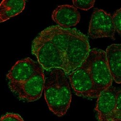 SLC34A1 Antibody, Novus Biologicals 0.1mL; Unlabeled:Antibodies, Polyclonal