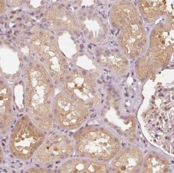 SLC34A1 Antibody, Novus Biologicals 0.1mL; Unlabeled:Antibodies, Polyclonal