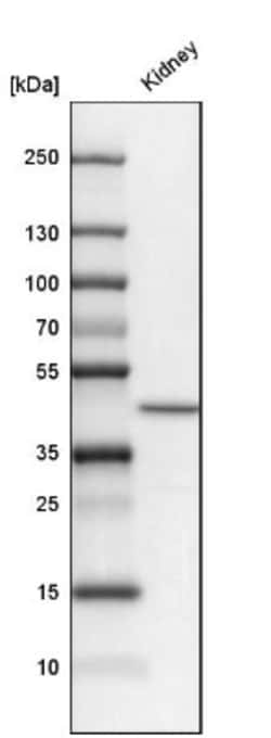 SLC34A1 Antibody, Novus Biologicals 0.1mL; Unlabeled:Antibodies, Polyclonal