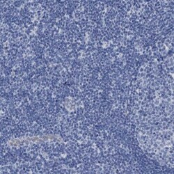 SLC34A3 Antibody, Novus Biologicals 25 &mu;L; Unlabeled:Antibodies, Polyclonal