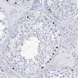 SLC35A5 Antibody, Novus Biologicals:Antibodies:Primary Antibodies