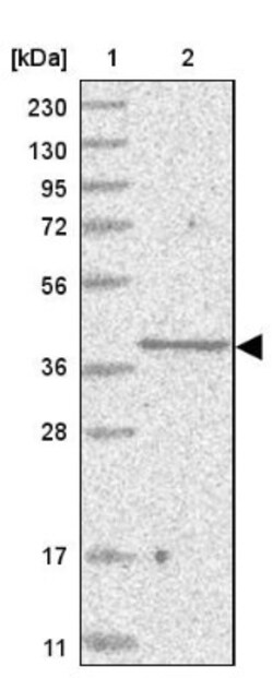 SLC35A5 Antibody, Novus Biologicals:Antibodies:Primary Antibodies