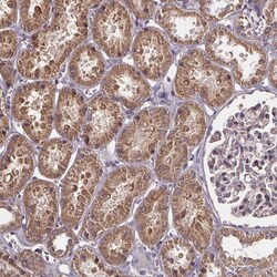 SLC35D2 Antibody, Novus Biologicals:Antibodies:Primary Antibodies