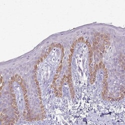 SLC35E2 Antibody, Novus Biologicals 0.1mL; Unlabeled:Antibodies, Polyclonal