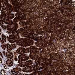 SLC35E4 Antibody, Novus Biologicals 25 &mu;L, Unlabeled:Antibodies, Polyclonal