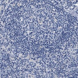 Syntaxin 6 Antibody, Novus Biologicals:Antibodies:Primary Antibodies