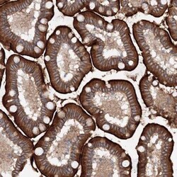 SLC36A1 Antibody, Novus Biologicals 0.1mL; Unlabeled:Antibodies, Polyclonal