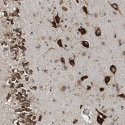 SLC36A4 Antibody, Novus Biologicals 25 &mu;L; Unlabeled:Antibodies, Polyclonal