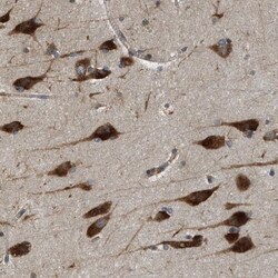SLC36A4 Antibody, Novus Biologicals 25 &mu;L; Unlabeled:Antibodies, Polyclonal