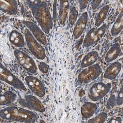 SLC36A4 Antibody, Novus Biologicals 25 &mu;L; Unlabeled:Antibodies, Polyclonal