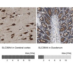 SLC36A4 Antibody, Novus Biologicals 25 &mu;L; Unlabeled:Antibodies, Polyclonal