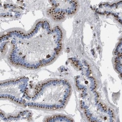 SLC37A2 Antibody, Novus Biologicals:Antibodies:Primary Antibodies