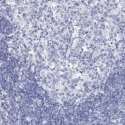 SLC37A4 Antibody, Novus Biologicals 25 &mu;L | Buy Online | Novus Biologicals | Fisher Scientific