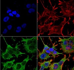 SLC38A1 Antibody (S104-32), Novus Biologicals 100&mu;g; Unlabeled:Antibodies,