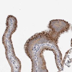 SLC38A10 Antibody, Novus Biologicals:Antibodies:Primary Antibodies