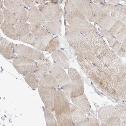 SLC38A10 Antibody, Novus Biologicals:Antibodies:Primary Antibodies