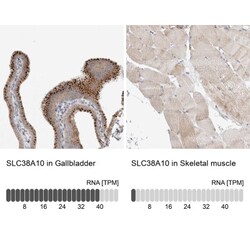 SLC38A10 Antibody, Novus Biologicals:Antibodies:Primary Antibodies