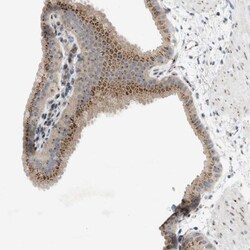 SLC38A10 Antibody, Novus Biologicals:Antibodies:Primary Antibodies