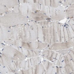 SLC38A10 Antibody, Novus Biologicals:Antibodies:Primary Antibodies