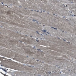 SLC38A10 Antibody, Novus Biologicals 0.1mL; Unlabeled:Antibodies, Polyclonal