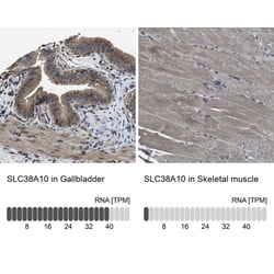 SLC38A10 Antibody, Novus Biologicals 0.1mL; Unlabeled:Antibodies, Polyclonal