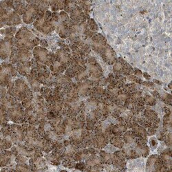 SLC38A2 Antibody, Novus Biologicals 0.1mL; Unlabeled:Antibodies, Polyclonal