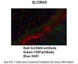 SLC38A3 Antibody, Novus Biologicals 100μL; Unlabeled:Antibodies, Polyclonal