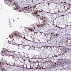 SLC38A5 Antibody, Novus Biologicals:Antibodies:Primary Antibodies