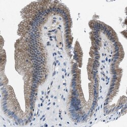 SLC38A6 Antibody, Novus Biologicals:Antibodies:Primary Antibodies