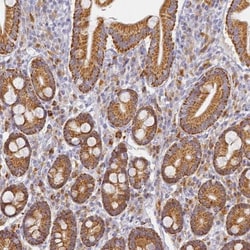 SLC38A9 Antibody, Novus Biologicals 0.1mL; Unlabeled:Antibodies, Polyclonal