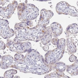 SLC38A9 Antibody, Novus Biologicals 0.1mL; Unlabeled:Antibodies, Polyclonal