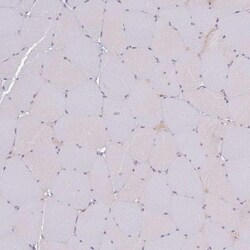 SLC38A9 Antibody, Novus Biologicals 0.1mL; Unlabeled:Antibodies, Polyclonal