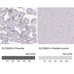 SLC38A9 Antibody, Novus Biologicals 0.1mL; Unlabeled:Antibodies, Polyclonal