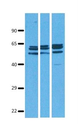 SLC38A9 Antibody, Novus Biologicals 0.05mg; Unlabeled:Antibodies, Polyclonal