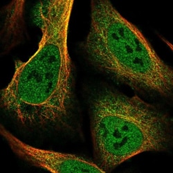 SLC39A10 Antibody, Novus Biologicals 25 &mu;L, Unlabeled:Antibodies, Polyclonal