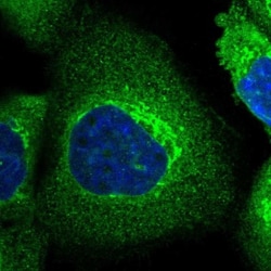SLC39A14 Antibody, Novus Biologicals:Antibodies:Primary Antibodies