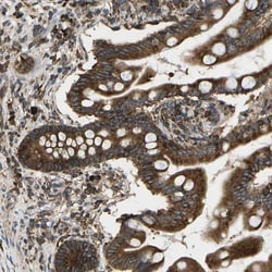 SLC39A14 Antibody, Novus Biologicals:Antibodies:Primary Antibodies