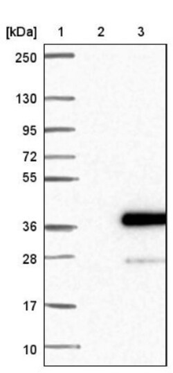 SLC39A3 Antibody, Novus Biologicals 0.1mL; Unlabeled:Antibodies, Polyclonal