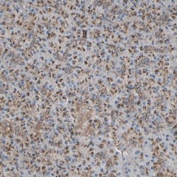 SLC39A9/ZIP9 Antibody, Novus Biologicals 0.1mL; Unlabeled:Antibodies, Polyclonal