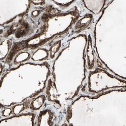 SLC39A9/ZIP9 Antibody, Novus Biologicals 0.1mL; Unlabeled:Antibodies, Polyclonal