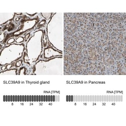 SLC39A9/ZIP9 Antibody, Novus Biologicals 0.1mL; Unlabeled:Antibodies, Polyclonal