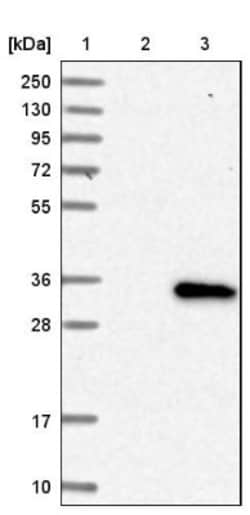 SLC39A9/ZIP9 Antibody, Novus Biologicals 0.1mL; Unlabeled:Antibodies, Polyclonal