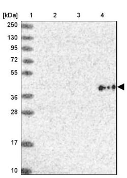 SLC3A1 Antibody, Novus Biologicals 0.1mL; Unlabeled:Antibodies, Polyclonal
