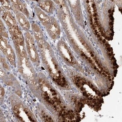 SLC41A2 Antibody, Novus Biologicals 0.1mL; Unlabeled:Antibodies, Polyclonal