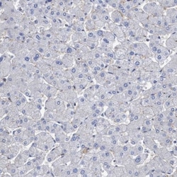 SLC43A2 Antibody, Novus Biologicals 0.1mL; Unlabeled:Antibodies, Polyclonal