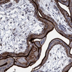 SLC43A2 Antibody, Novus Biologicals 0.1mL; Unlabeled:Antibodies, Polyclonal