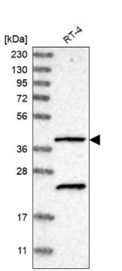 SLC43A2 Antibody, Novus Biologicals 0.1mL; Unlabeled:Antibodies, Polyclonal